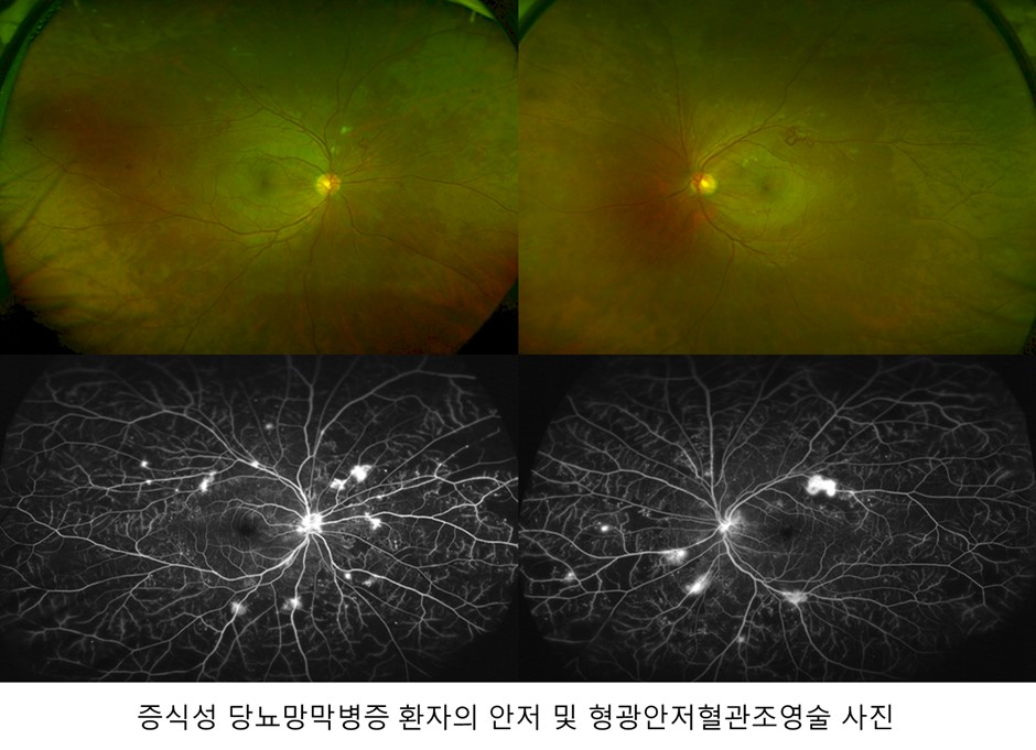 개의 눈에 혈관이 부러지는 원인