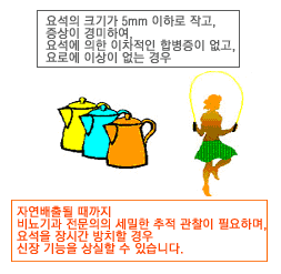 요석의 크리가 5mm이하로 작고, 증상이 경미하여, 요석에 의한 이차적인 합병증이 없고, 요로에 이상이 없는 경우. 자연배출될 때까지 비뇨기과 전문의의 세밀한 추적 관찰이 필요하며, 요석을 장시간 방치할 경우 신장 기능을 상실할 수 있습니다. 