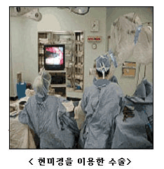 현미경을 이용한 수술